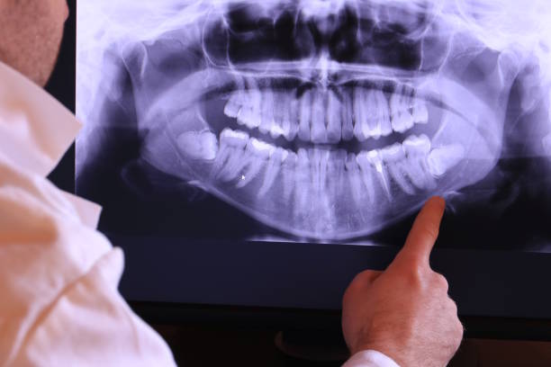 Best Emergency Dentist for Special Needs Patients in Crest Hl, IL